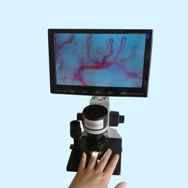 Layar LCD Warna Uji Mikrosirkulasi Rumah Sakit Klinik
